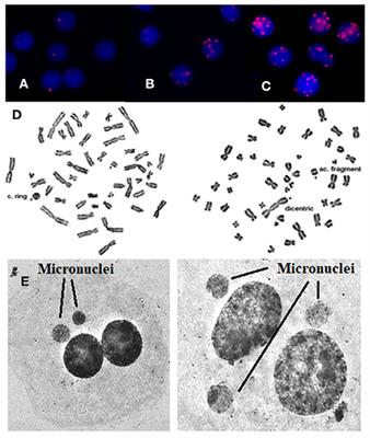 The Use of Genotoxicity Endpoints as Biomarkers of Low Dose Radiation Exposure in Interventional Cardiology